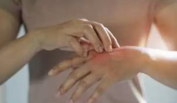 Protecting skin from concrete burns | EasyMix Concrete 